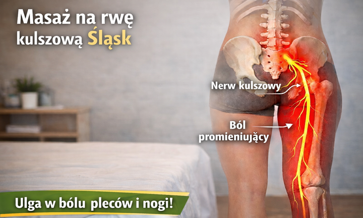 Kobieta z bólem lędźwi i promieniowaniem do nogi – anatomia nerwu kulszowego, masaż na rwę kulszową Tychy.png